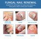 💅✨Nail Fungus Treatment Solution – Stronger, Healthier Nails In Seconds💖