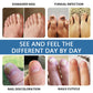 💅✨Nail Fungus Treatment Solution – Stronger, Healthier Nails In Seconds💖