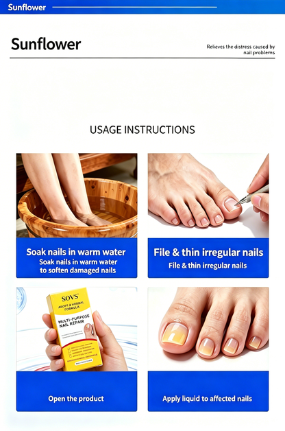 💅✨Nail Fungus Treatment Solution – Stronger, Healthier Nails In Seconds💖