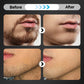 6-Blade Razor with Easy Snap-In Head