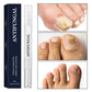 Toenail Fungus Treatment Pen for Damaged Nails 💅Easily Achieve Glossy Nails